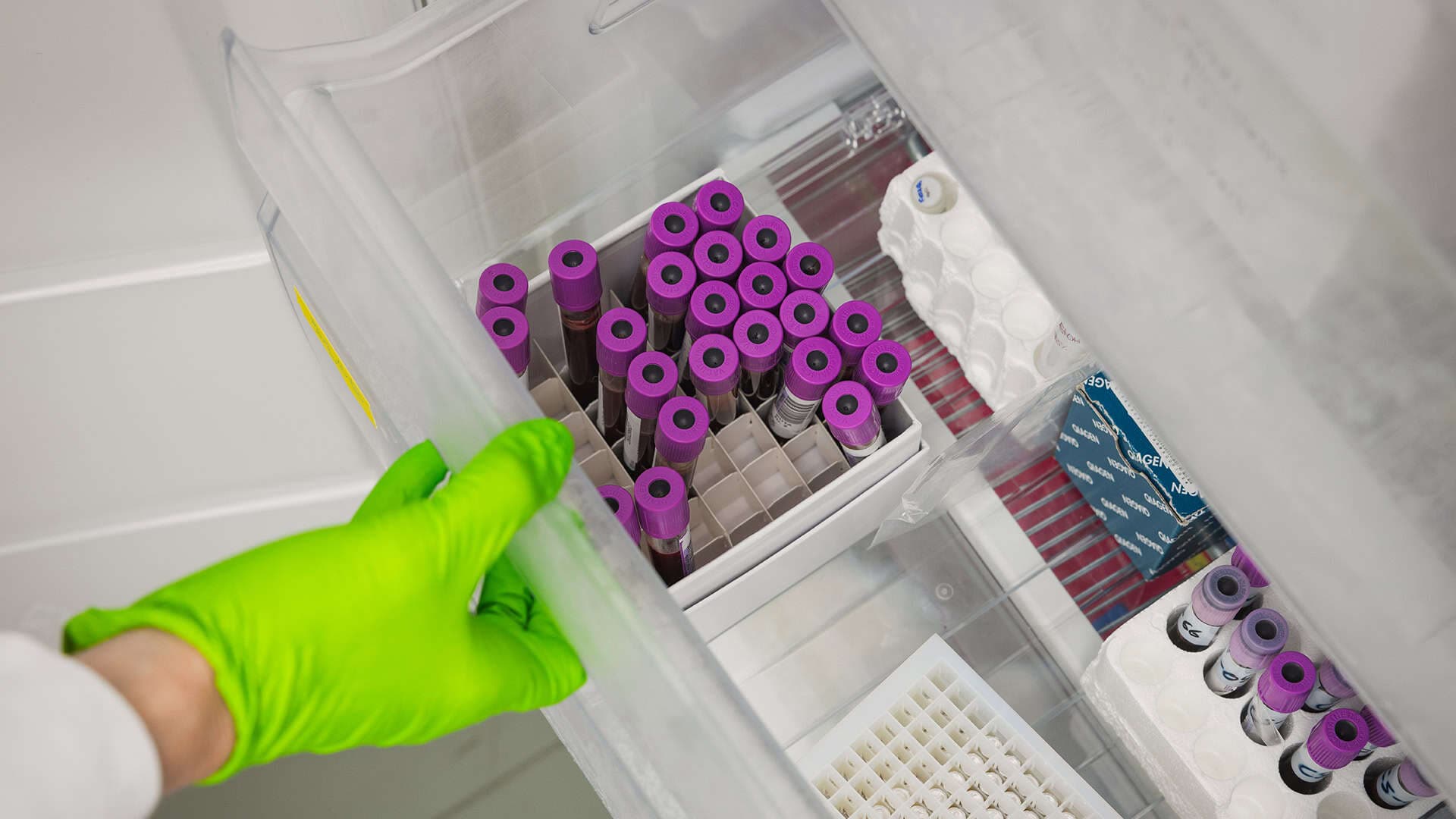 En låda med provrör.